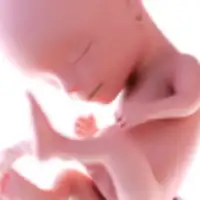 Mi Embarazo